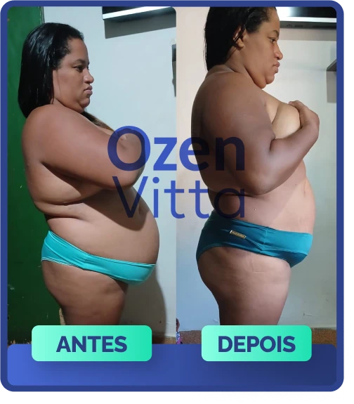 Antes e depois 1